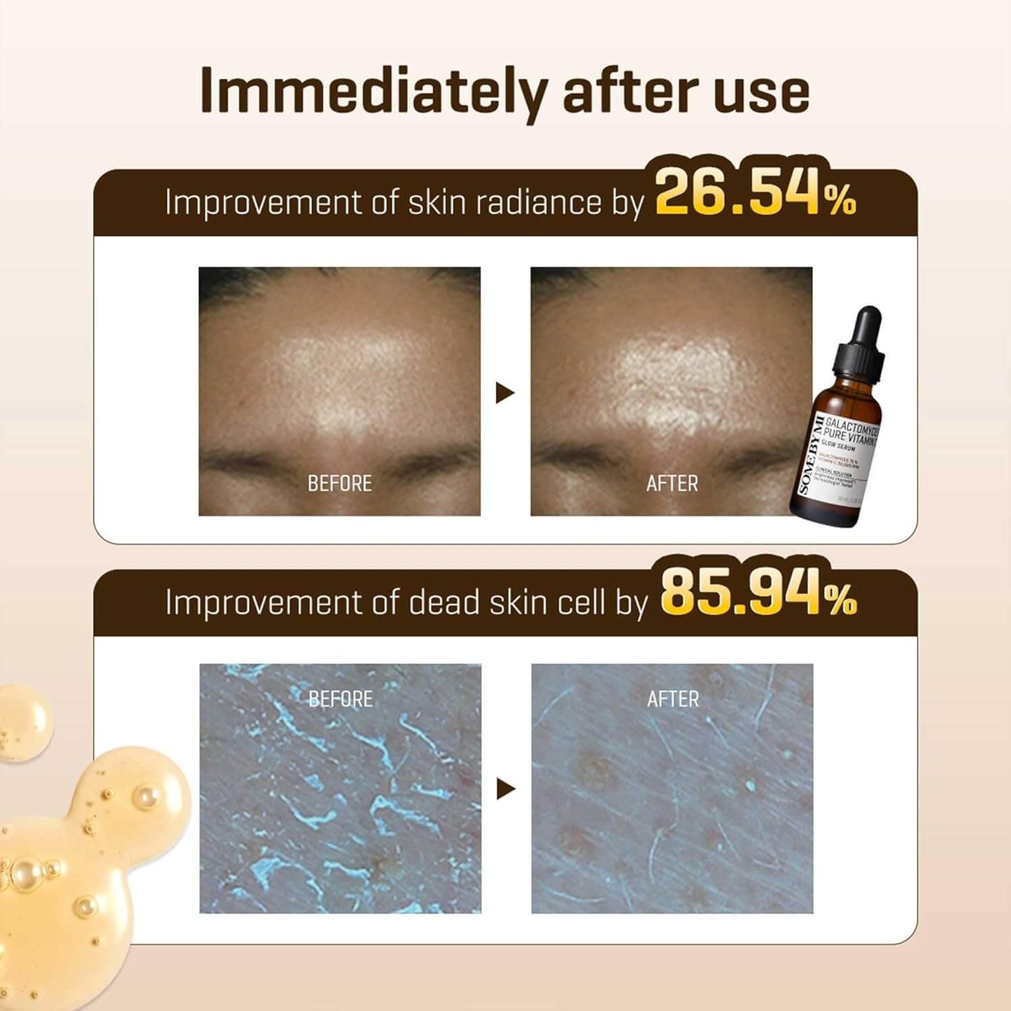 SOMEBYMI Galactomyces Pure Vitamin C Glow Serum 30ml-SKEEN
