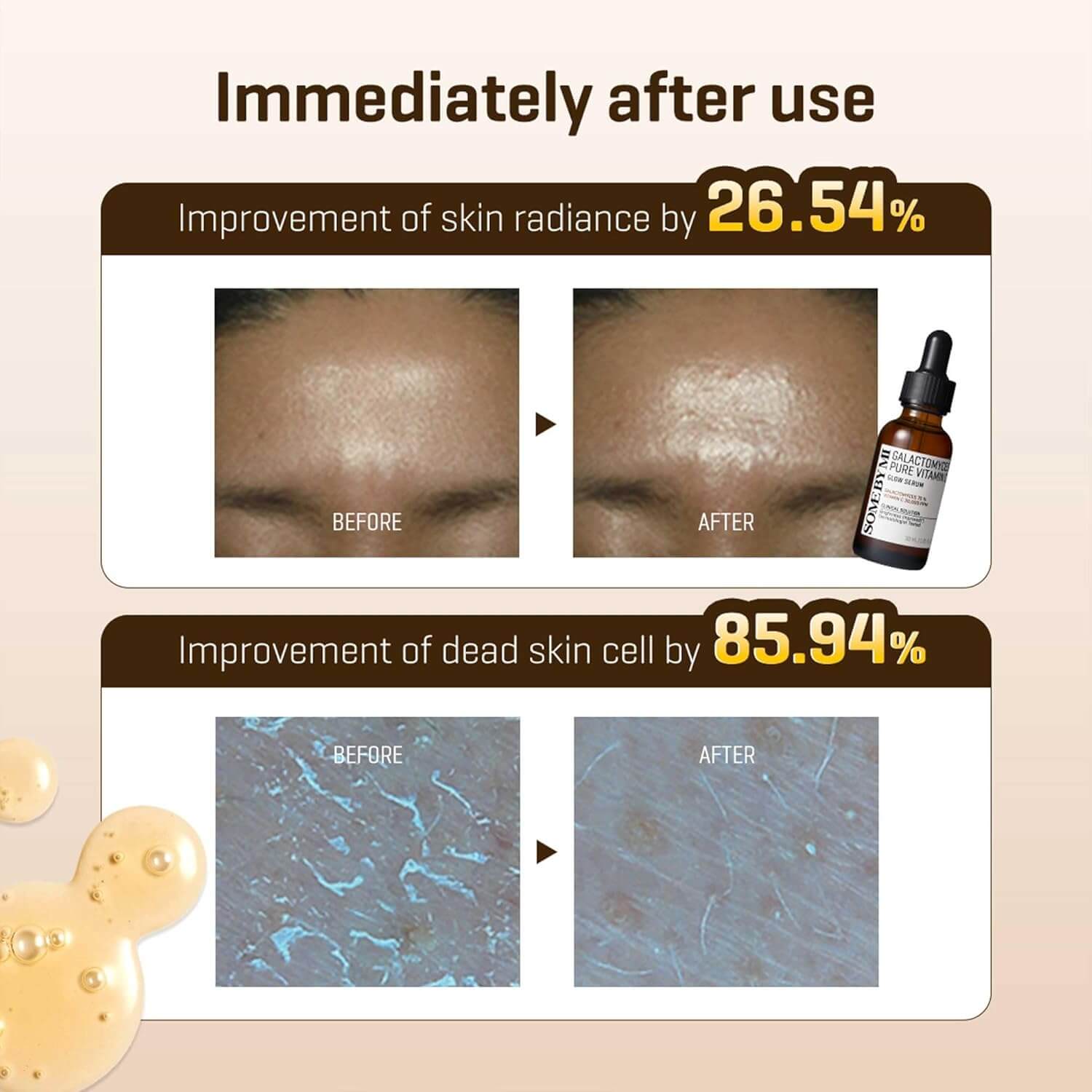 SOMEBYMI Galactomyces Pure Vitamin C Glow Serum 30ml-SKEEN