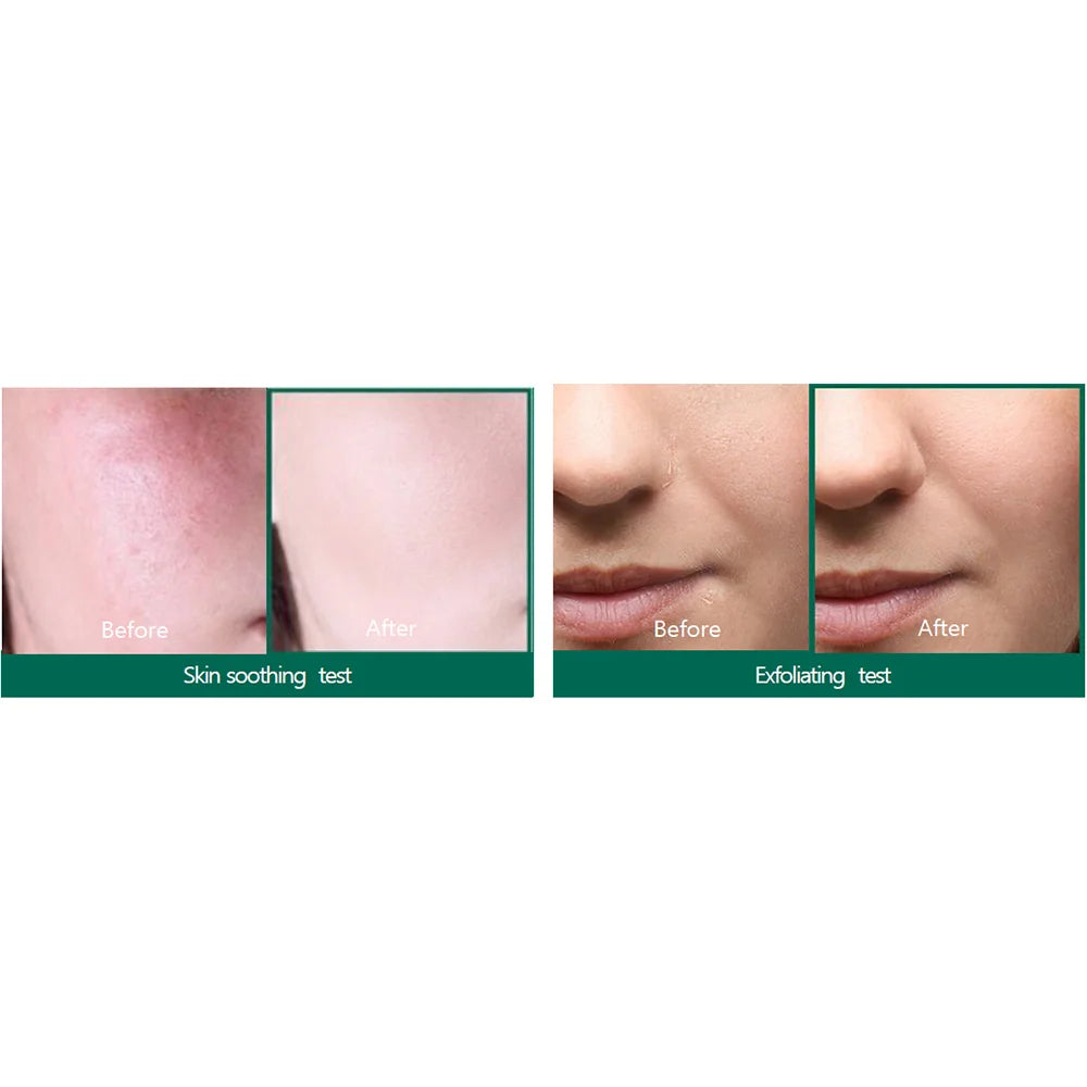 SOMEBYMI AHA-BHA-PHA 30 days Miracle Serum 50ml-SKEEN