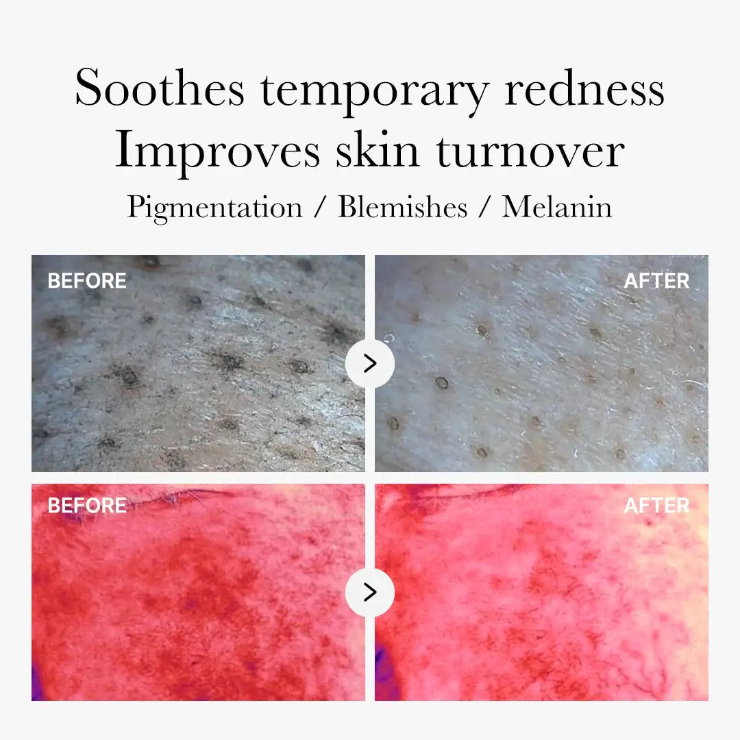 Medicube Red Succinic Acid Peeling Pads 70pcs 155g - Exfoliating-SKEEN