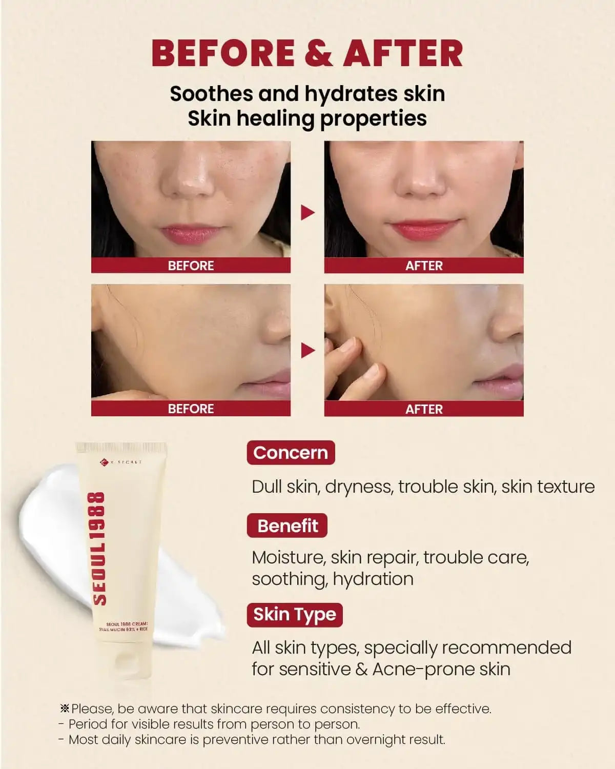 K-SECRET SEOUL 1988 Κρέμα: Βλεννίνη σαλιγκαριού 93% + Ρύζι 100ml