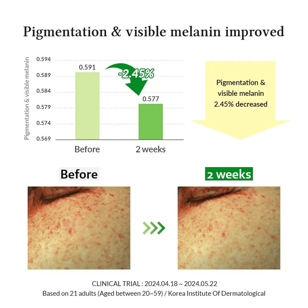 Dr.Althea Gentle Vitamin  C Serum 30ml