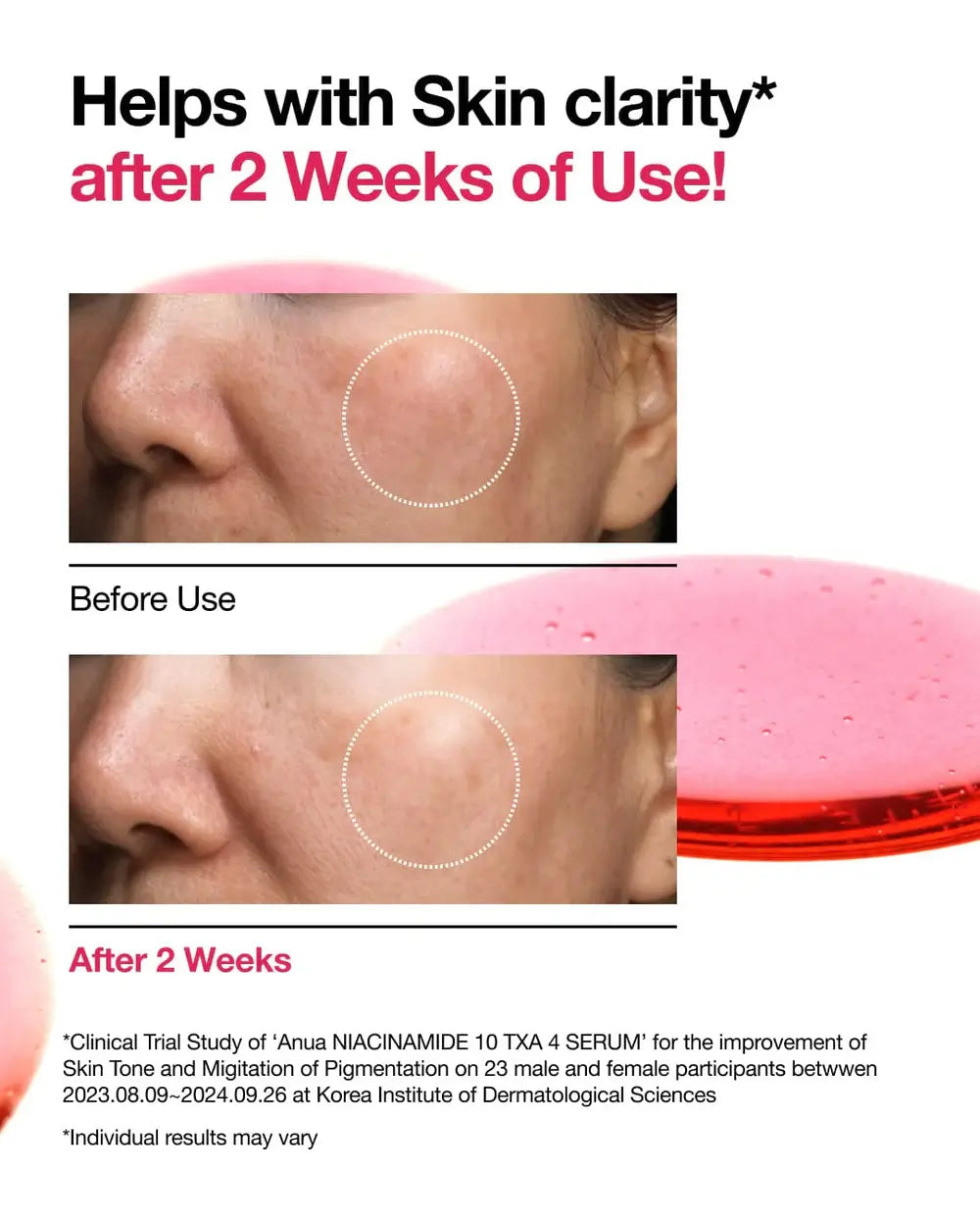ANUA Niacinamide 10% + TXA 4% Serum 30ml-SKEEN