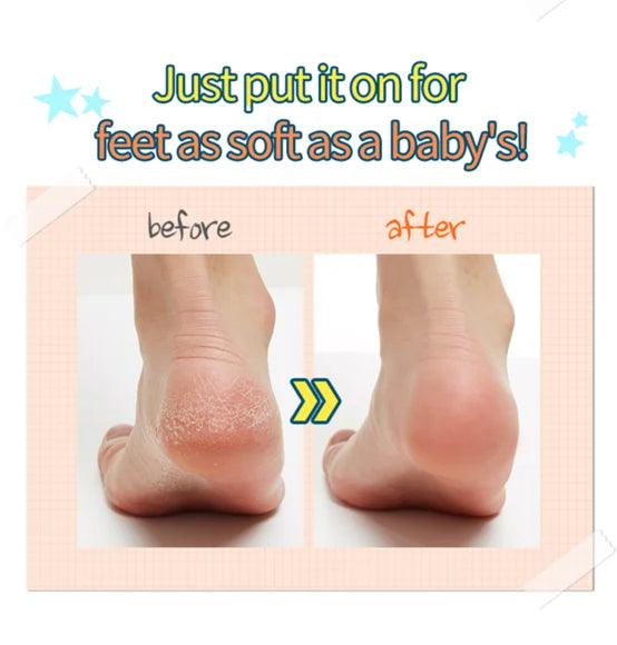 APIEU 30 Minute Soft Foot Peeling Socks 1pc