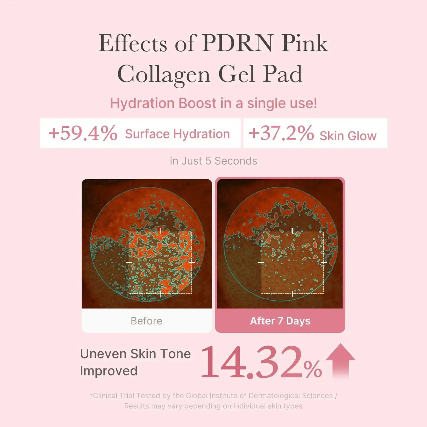 MEDICUBE PDRN Pink Cοllagen Toning Gel Toner Pads 120ml - 70pcs