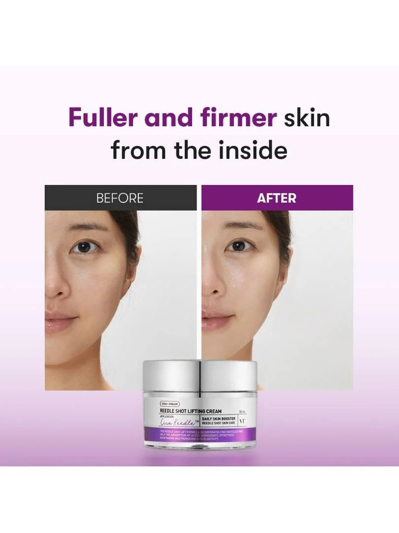 VT COSMETICS Reedle Shot Lifting Cream 50ml