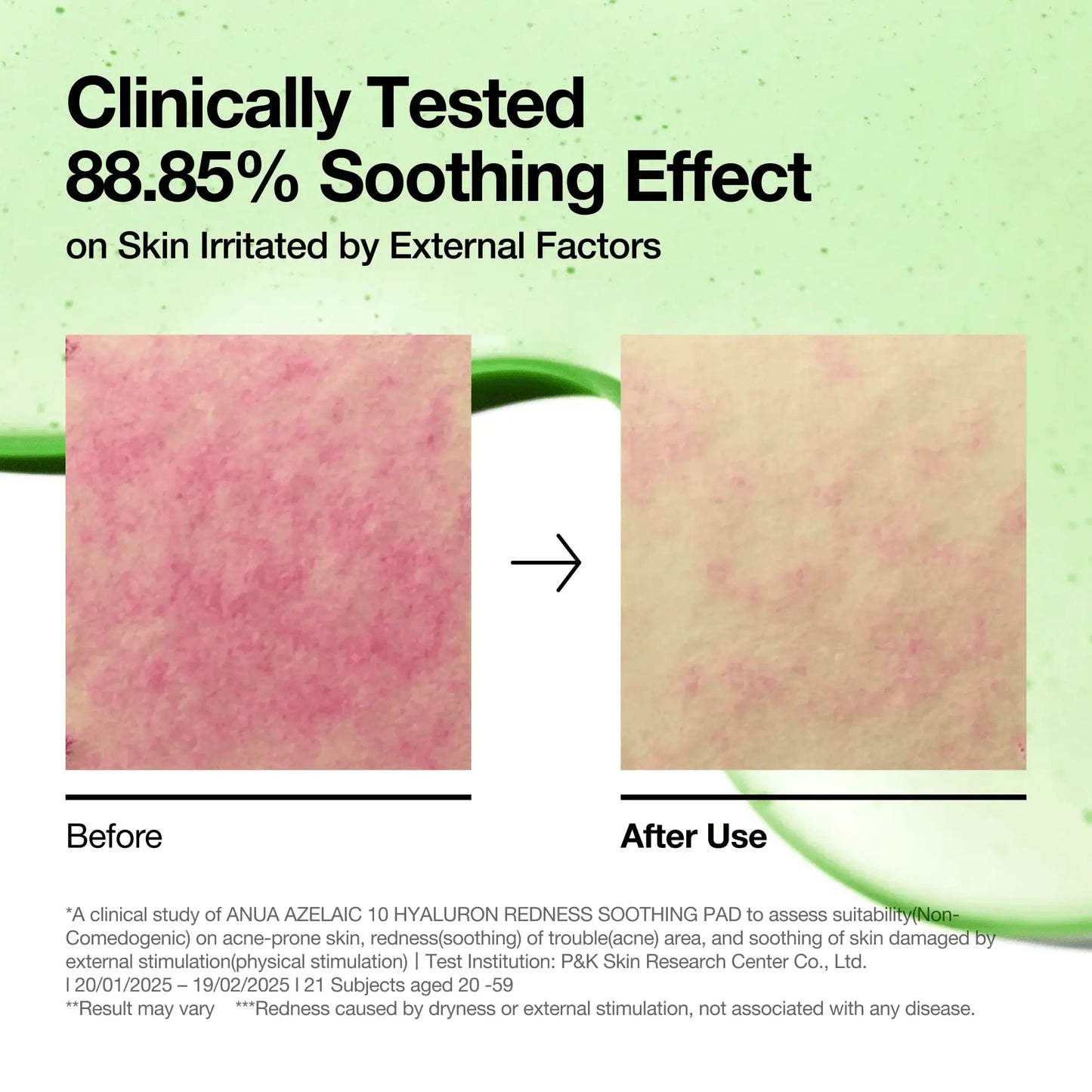 ANUA Azelaic 10 Hyaluron Redness Soothing Pad 230ml - 90pads
