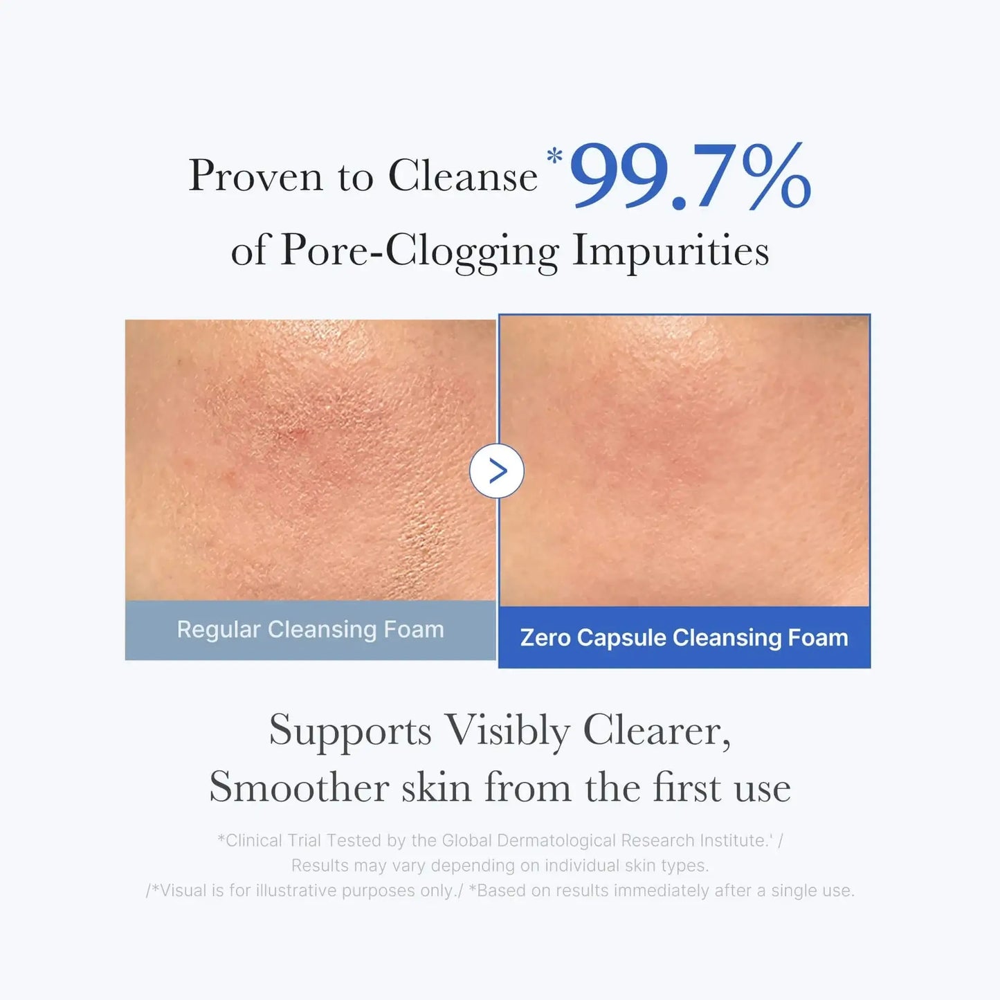 MEDICUBE Zero Pore Capsule Cleansing Foam 120g