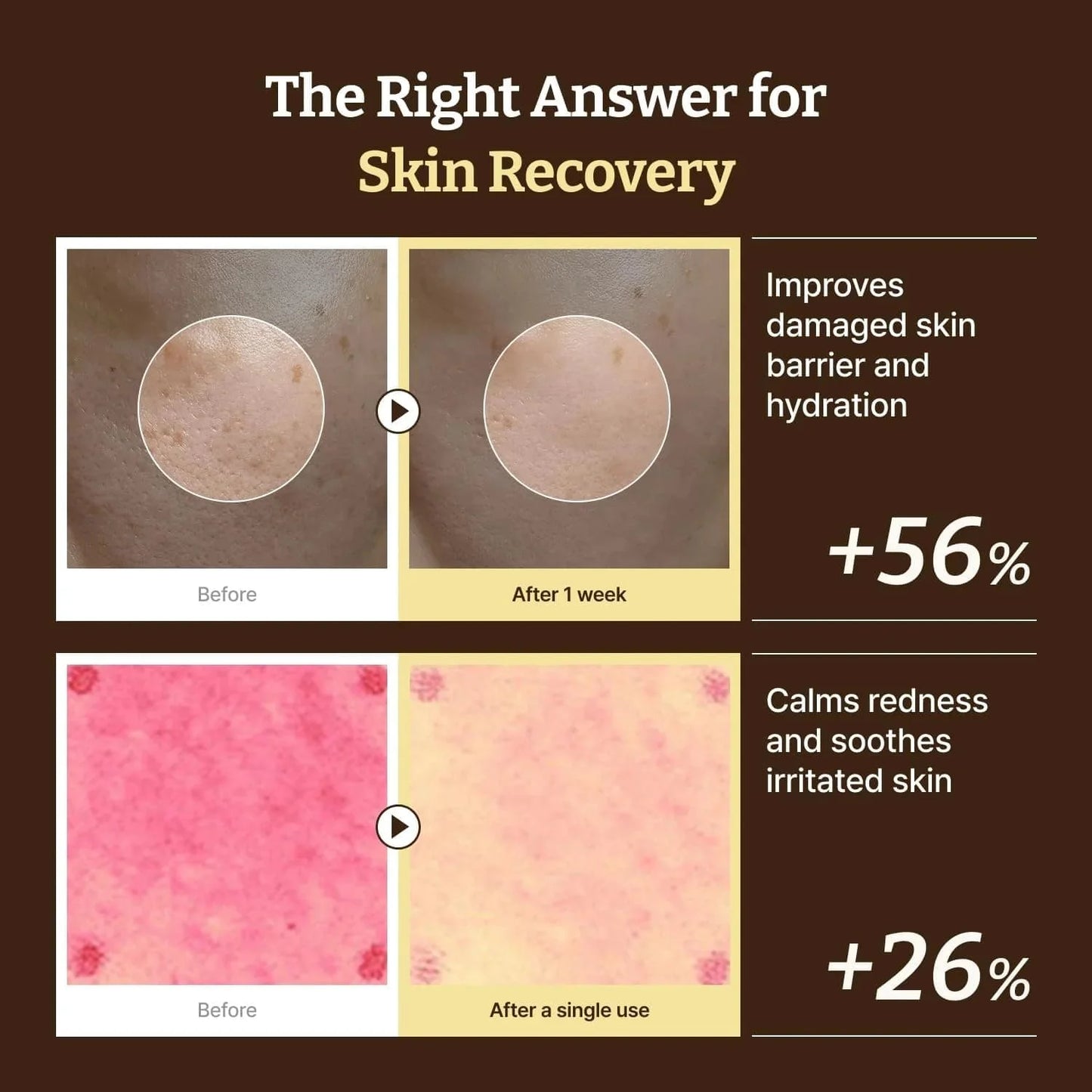 Dr. Reju-All Advanced PDRN Rejuvenating Cream 20ml