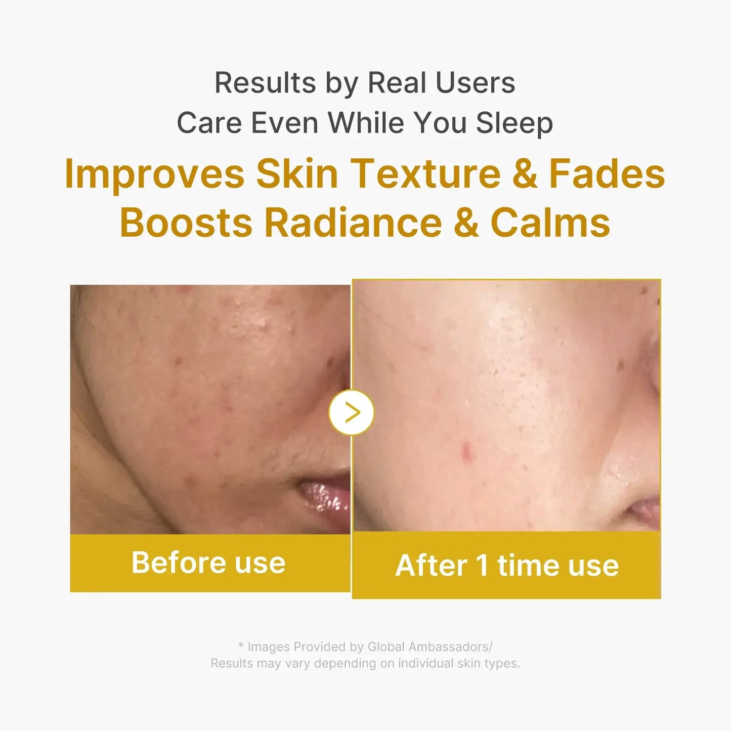 MEDICUBE Kojic Acid Turmeric Overnight Wrapping Mask 75ml